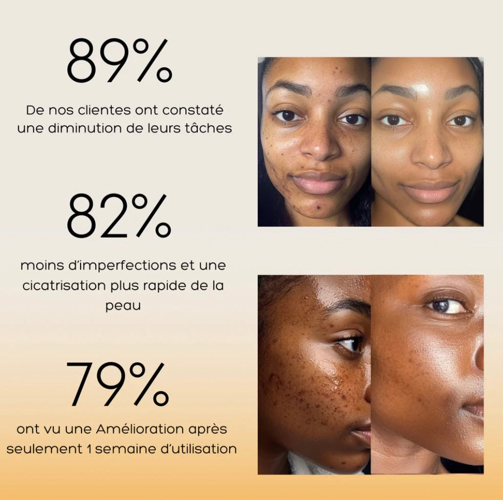Nettoyant visage au curcuma™️ 5000cfa