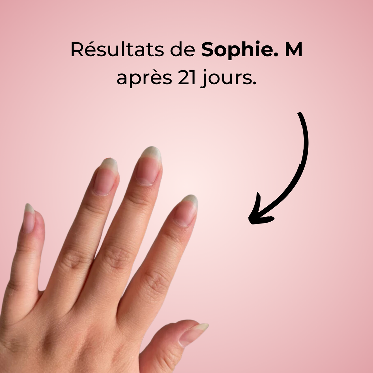 Sérum de Croissance des Ongles (1 Acheté = 1 OFFERT)